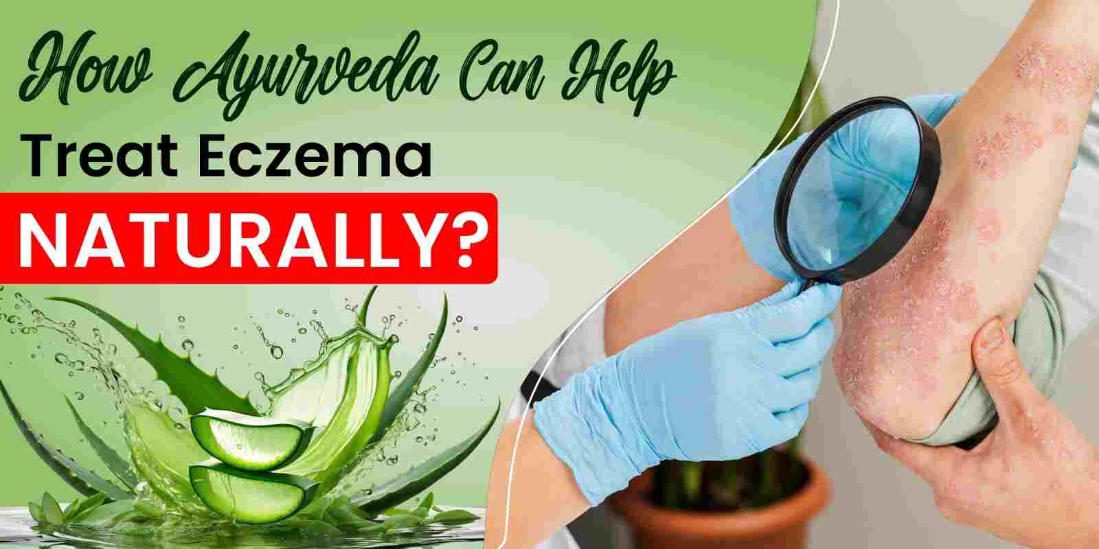 How Ayurveda Can Help Treat Eczema Naturally?